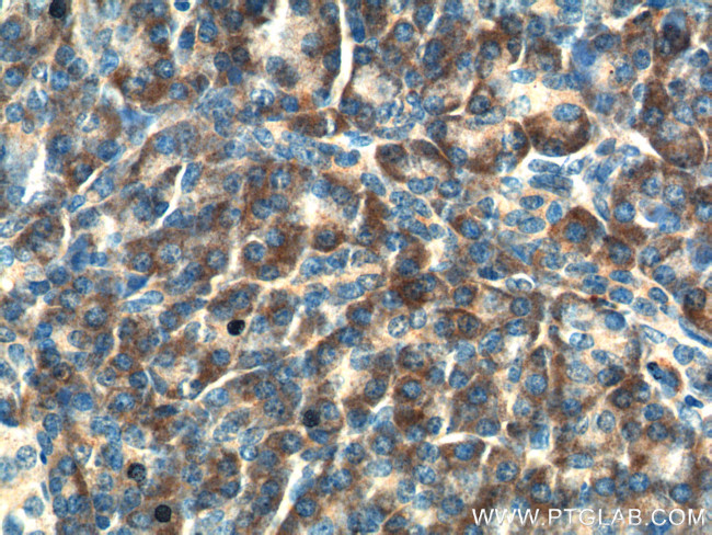 Maspin Antibody in Immunohistochemistry (Paraffin) (IHC (P))