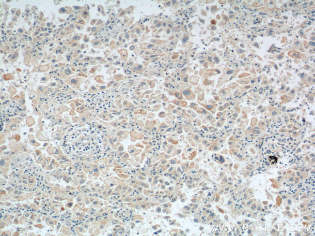 Maspin Antibody in Immunohistochemistry (Paraffin) (IHC (P))