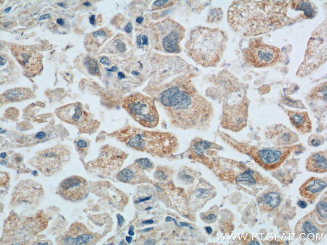 Maspin Antibody in Immunohistochemistry (Paraffin) (IHC (P))