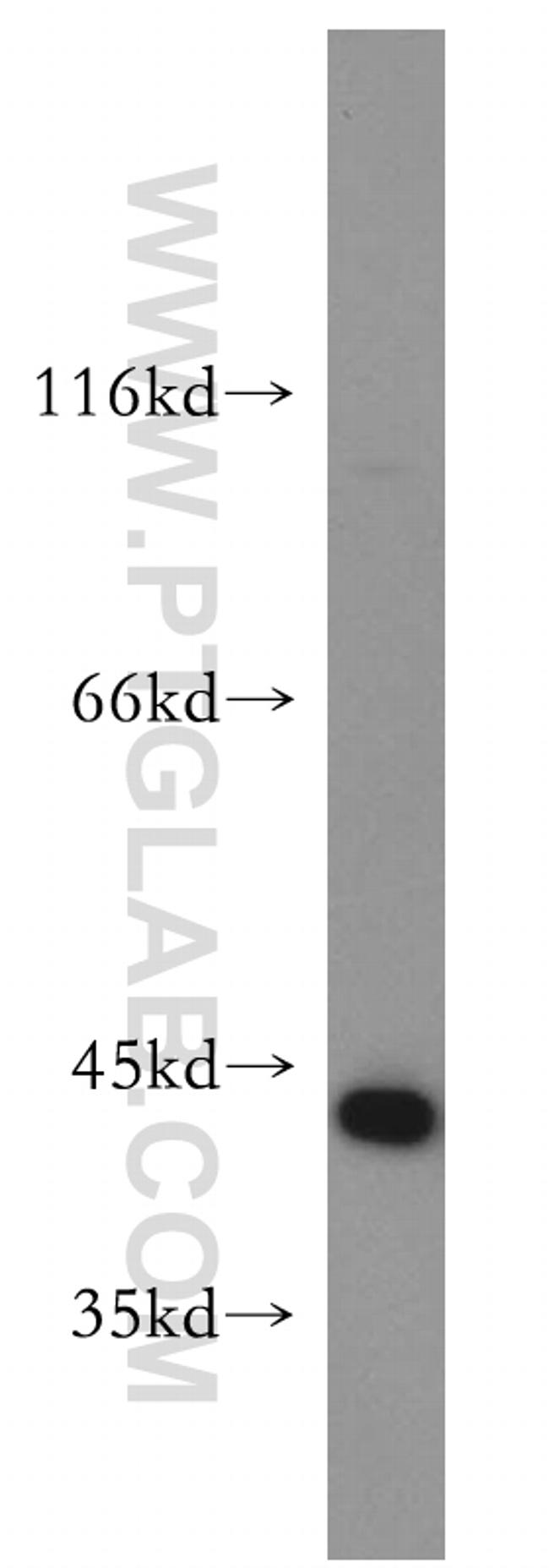 Maspin Antibody in Western Blot (WB)