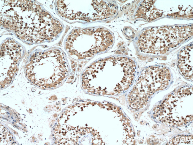 DDX39A Antibody in Immunohistochemistry (Paraffin) (IHC (P))