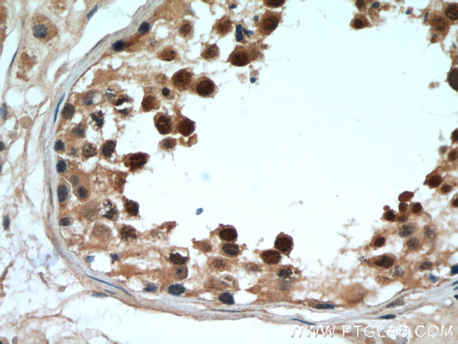 DDX39A Antibody in Immunohistochemistry (Paraffin) (IHC (P))