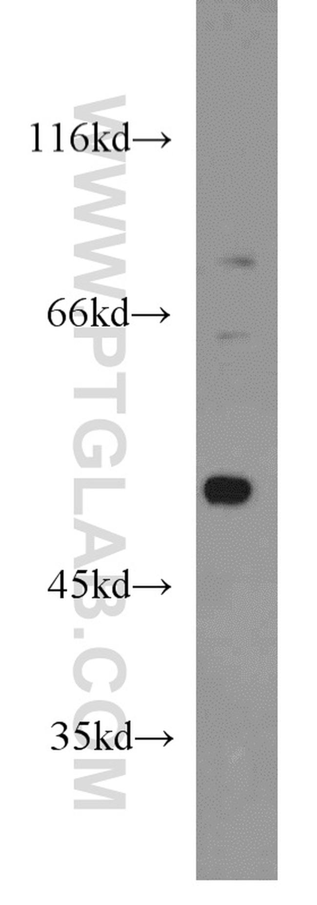 DDX39A Antibody in Western Blot (WB)