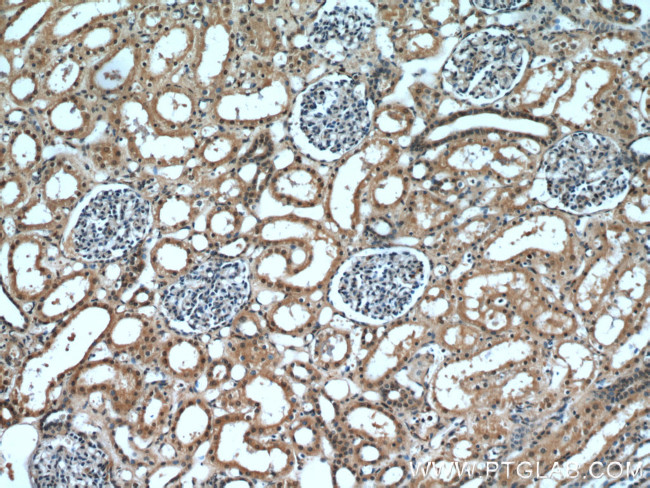 DDX39A Antibody in Immunohistochemistry (Paraffin) (IHC (P))