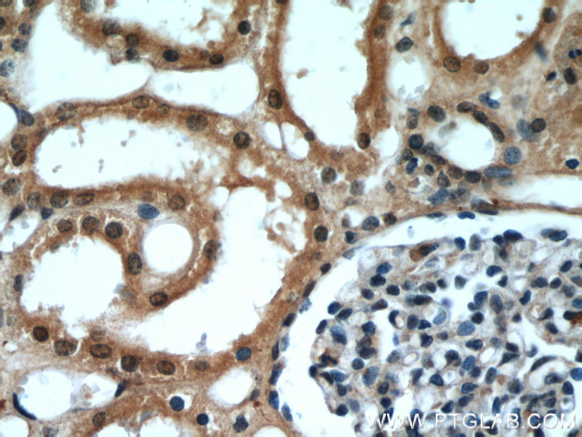 DDX39A Antibody in Immunohistochemistry (Paraffin) (IHC (P))