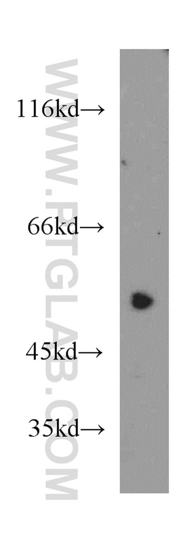 DDX39A Antibody in Western Blot (WB)