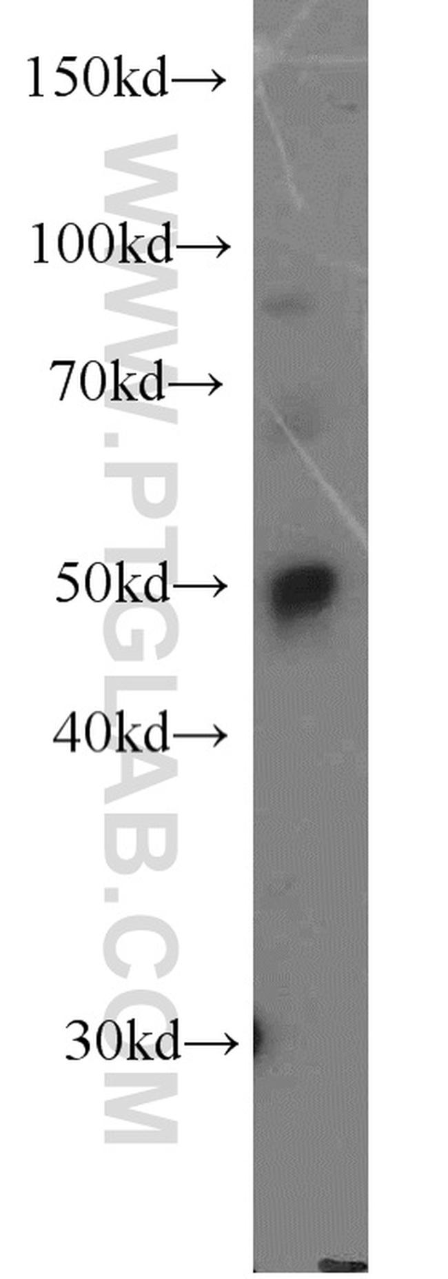 DDX39A Antibody in Western Blot (WB)