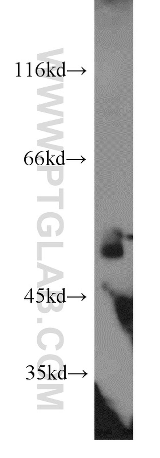 DDX39A Antibody in Western Blot (WB)