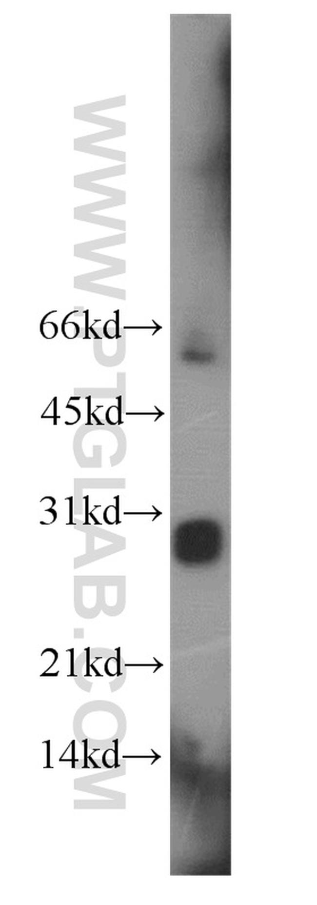 LIN28 Antibody in Western Blot (WB)