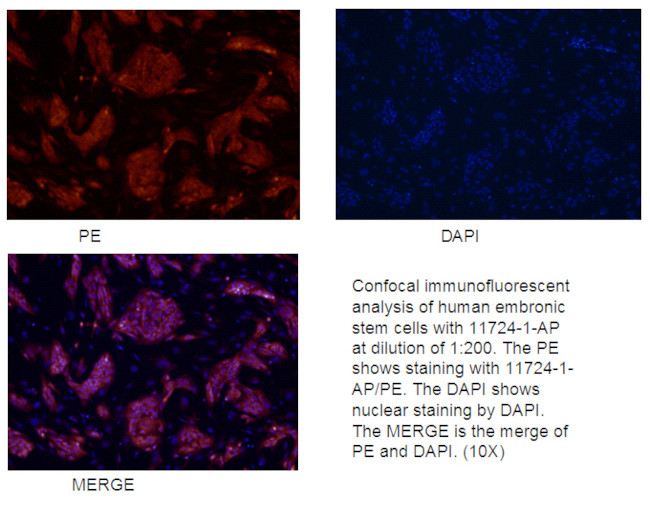 LIN28 Antibody in Immunocytochemistry (ICC/IF)