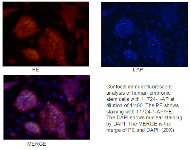 LIN28 Antibody in Immunocytochemistry (ICC/IF)