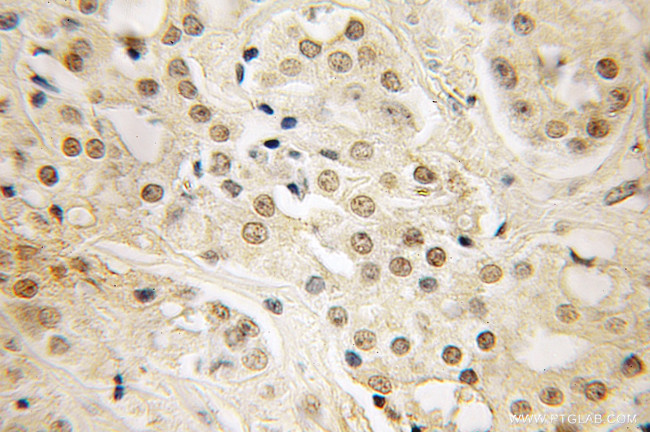 LIN28 Antibody in Immunohistochemistry (Paraffin) (IHC (P))