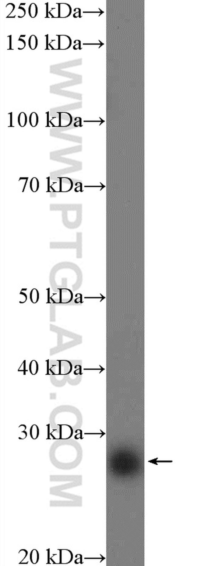 LIN28 Antibody in Western Blot (WB)