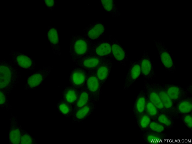 RAD1 Antibody in Immunocytochemistry (ICC/IF)