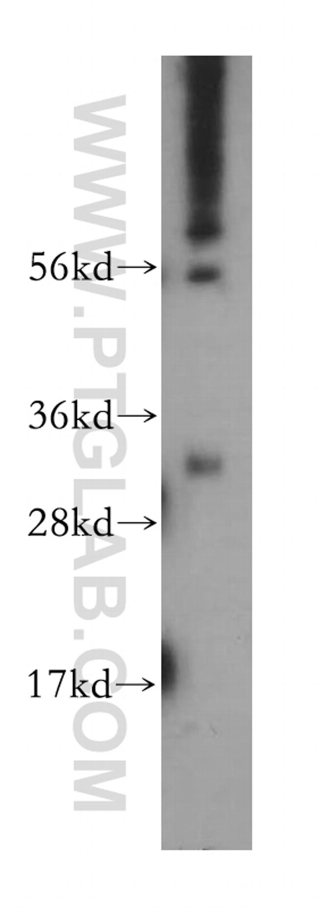 RAD1 Antibody in Western Blot (WB)