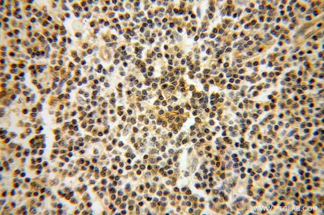 IFITM1 Antibody in Immunohistochemistry (Paraffin) (IHC (P))