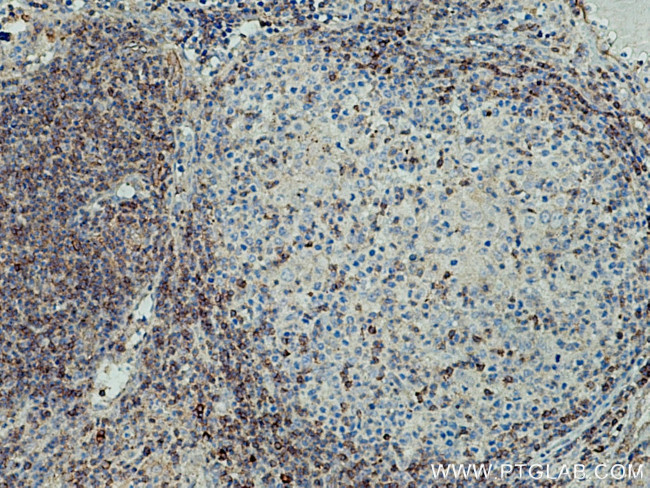 IFITM1 Antibody in Immunohistochemistry (Paraffin) (IHC (P))