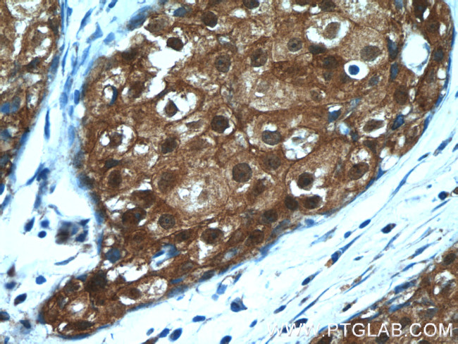 SRP54 Antibody in Immunohistochemistry (Paraffin) (IHC (P))