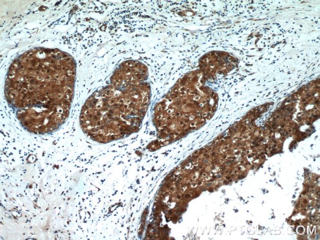 SRP54 Antibody in Immunohistochemistry (Paraffin) (IHC (P))