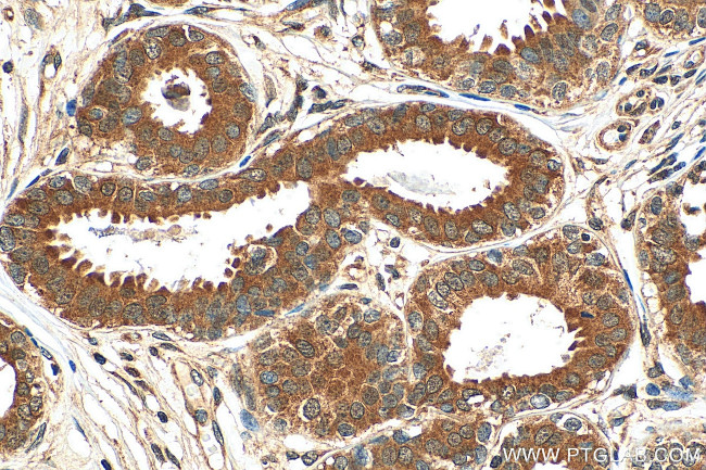 SRP54 Antibody in Immunohistochemistry (Paraffin) (IHC (P))