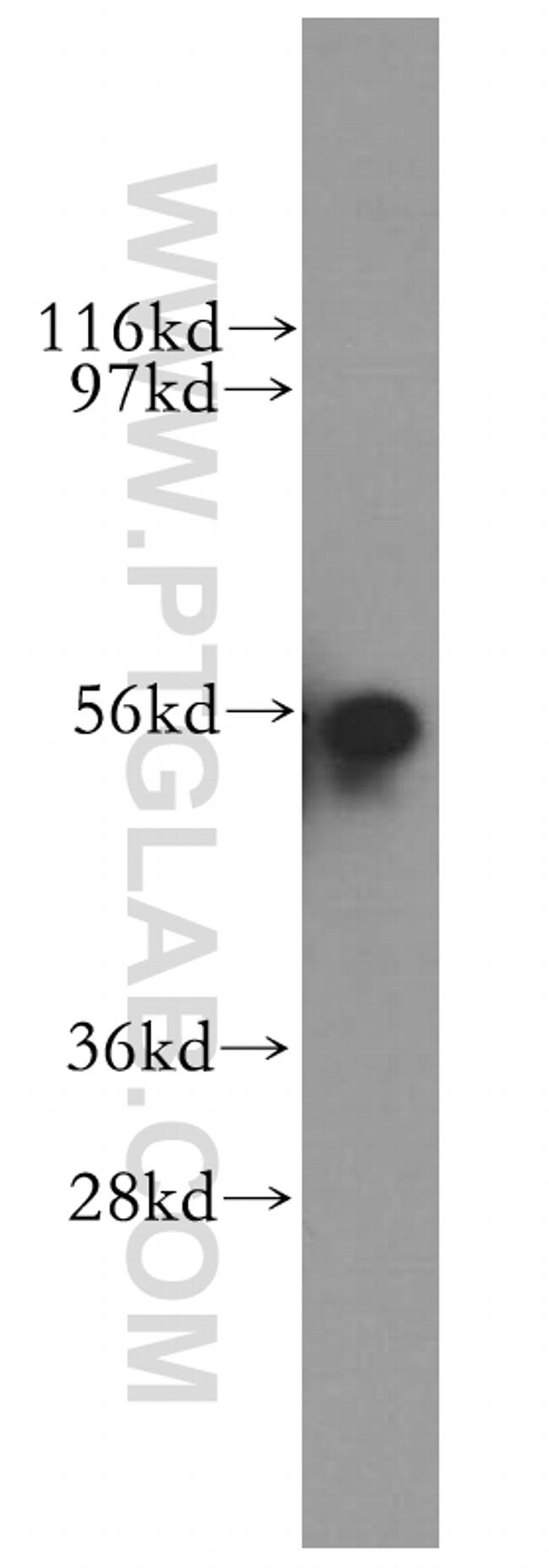 SRP54 Antibody in Western Blot (WB)