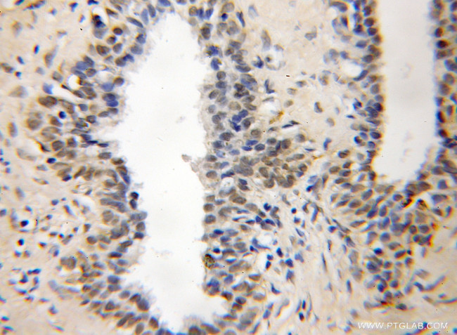 YPEL5 Antibody in Immunohistochemistry (Paraffin) (IHC (P))