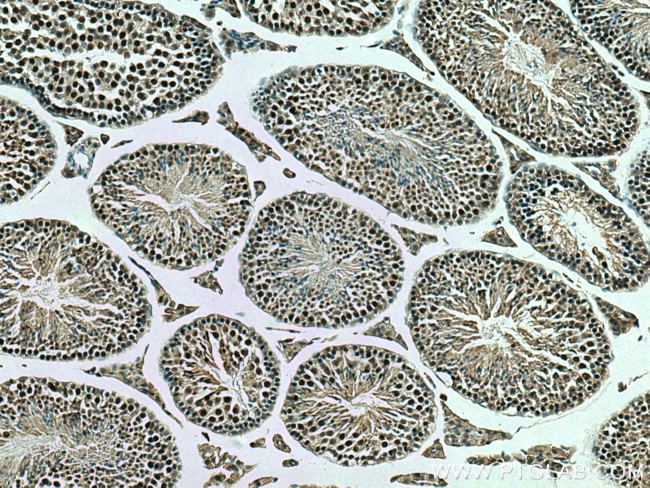 YPEL5 Antibody in Immunohistochemistry (Paraffin) (IHC (P))