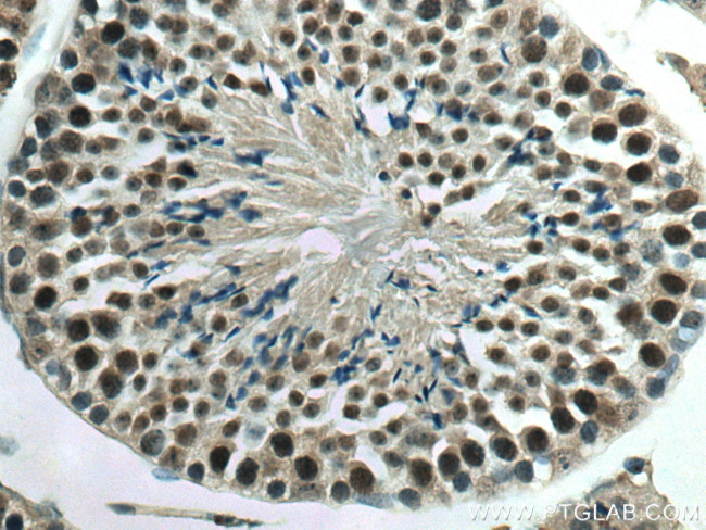 YPEL5 Antibody in Immunohistochemistry (Paraffin) (IHC (P))