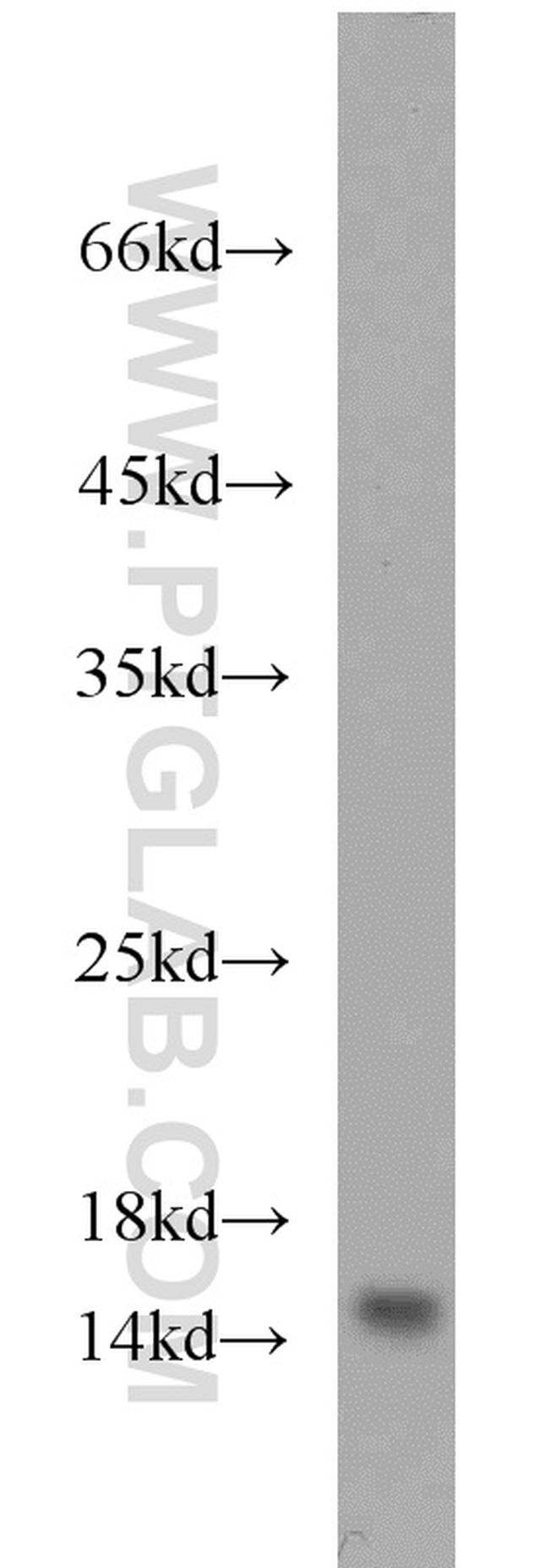 YPEL5 Antibody in Western Blot (WB)