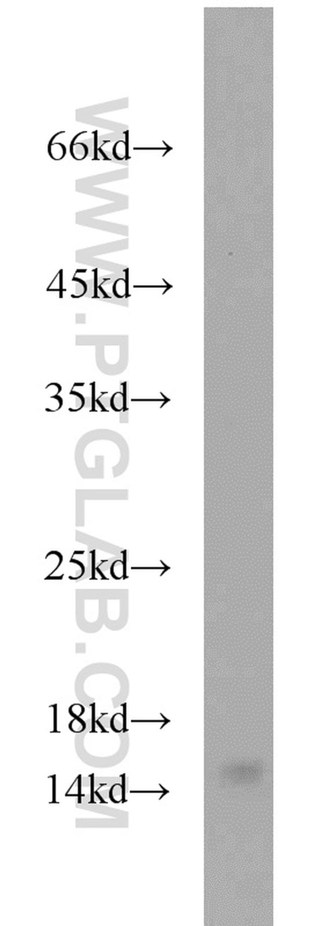 YPEL5 Antibody in Western Blot (WB)