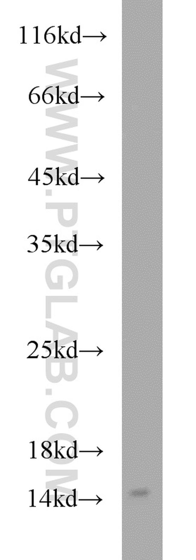 YPEL5 Antibody in Western Blot (WB)