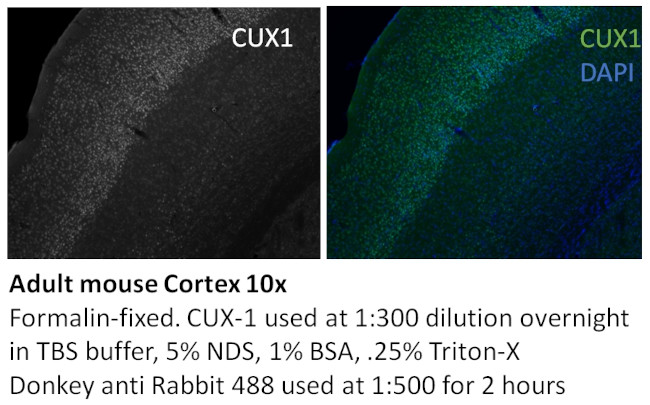 CUX1/Protein CASP Antibody in Immunohistochemistry (Paraffin) (IHC (P))