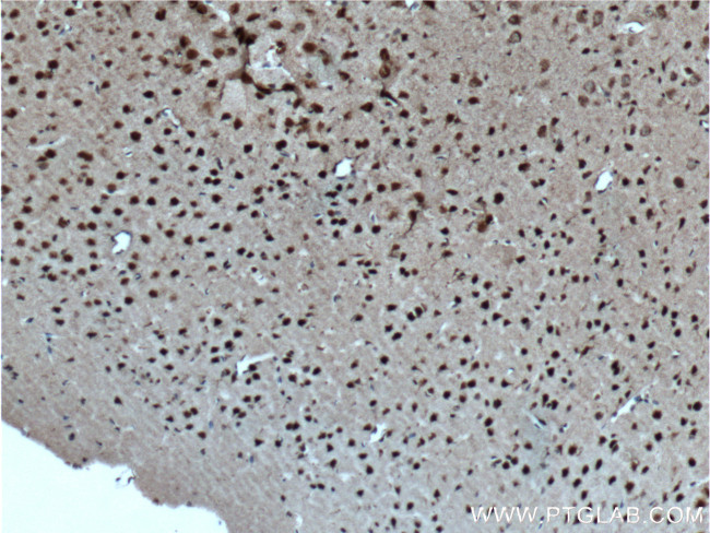 CUX1/Protein CASP Antibody in Immunohistochemistry (Paraffin) (IHC (P))