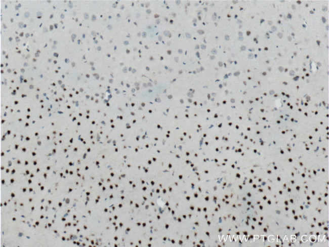 CUX1/Protein CASP Antibody in Immunohistochemistry (Paraffin) (IHC (P))