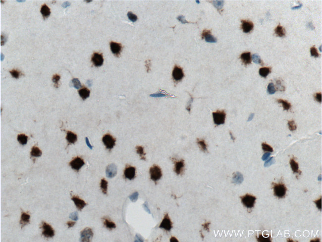 CUX1/Protein CASP Antibody in Immunohistochemistry (Paraffin) (IHC (P))