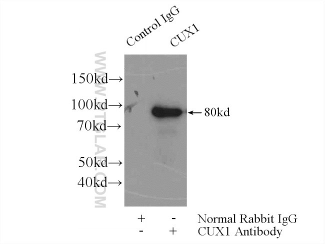 CUX1/Protein CASP Antibody in Immunoprecipitation (IP)