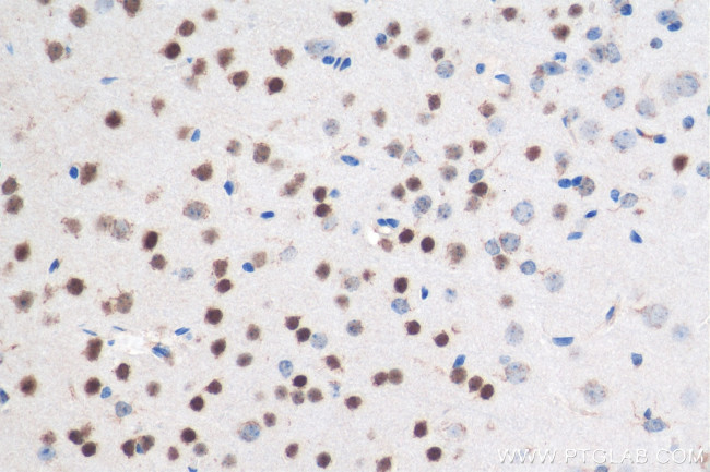 CUX1/Protein CASP Antibody in Immunohistochemistry (Paraffin) (IHC (P))