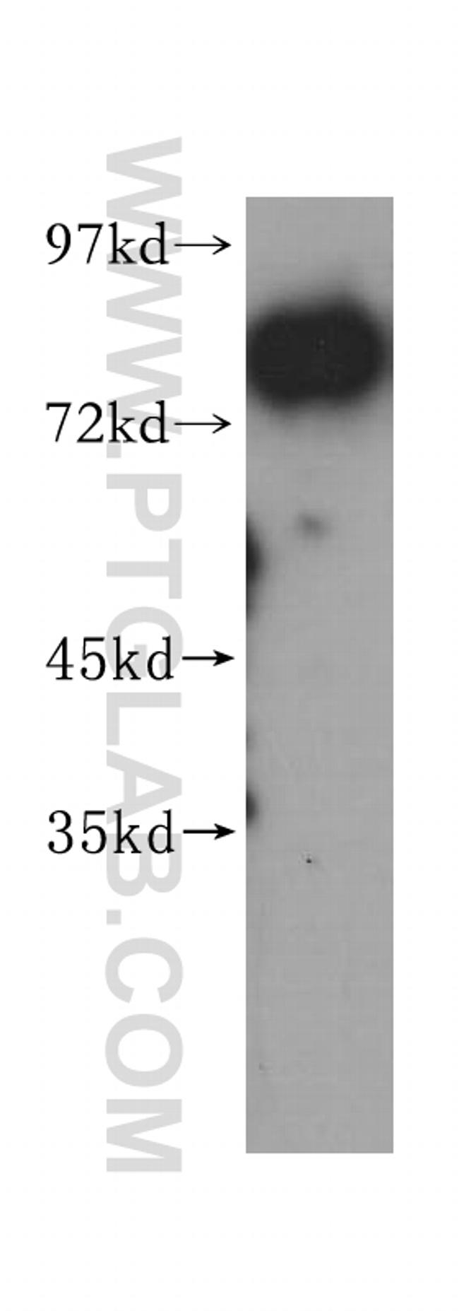 CUX1/Protein CASP Antibody in Western Blot (WB)