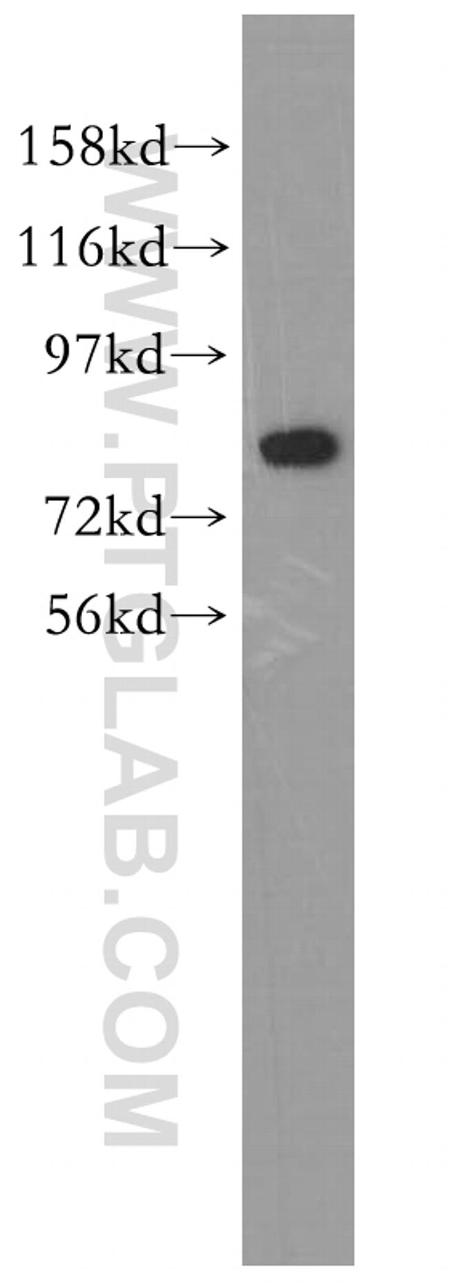 CUX1/Protein CASP Antibody in Western Blot (WB)