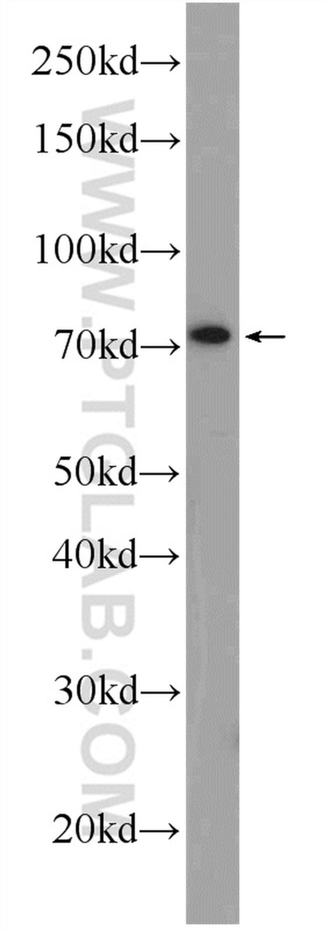 CUX1/Protein CASP Antibody in Western Blot (WB)