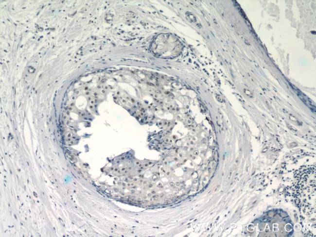 EID1 Antibody in Immunohistochemistry (Paraffin) (IHC (P))