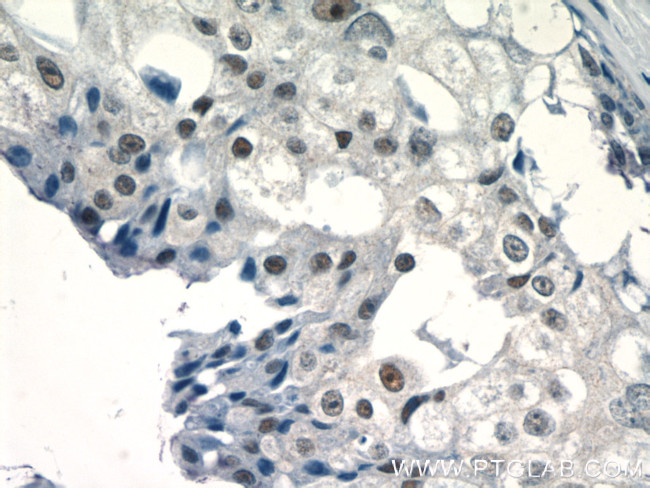 EID1 Antibody in Immunohistochemistry (Paraffin) (IHC (P))