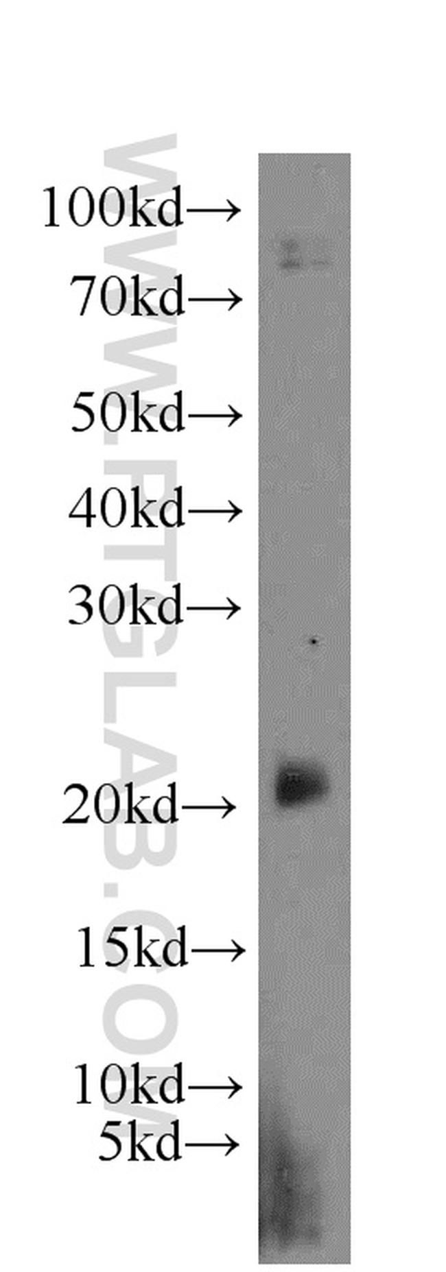 EID1 Antibody in Western Blot (WB)