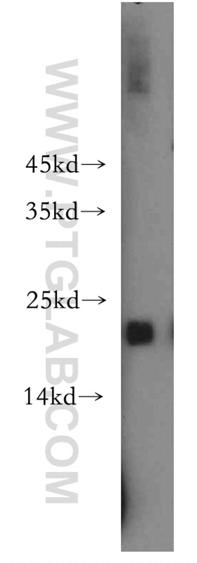 EID1 Antibody in Western Blot (WB)