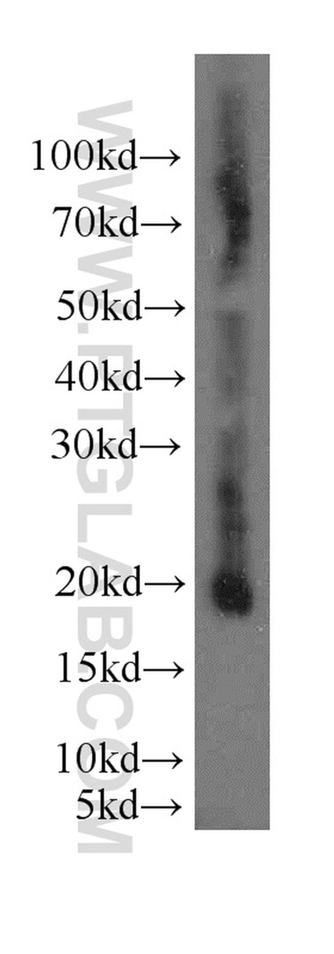 EID1 Antibody in Western Blot (WB)