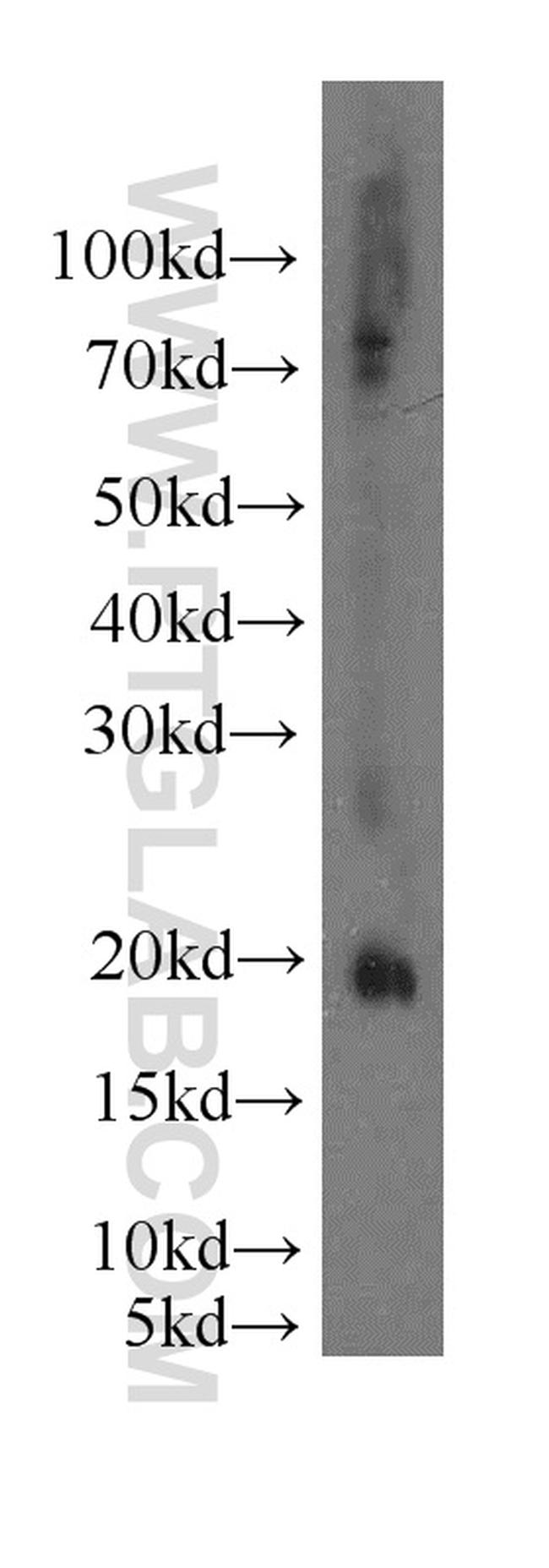 EID1 Antibody in Western Blot (WB)