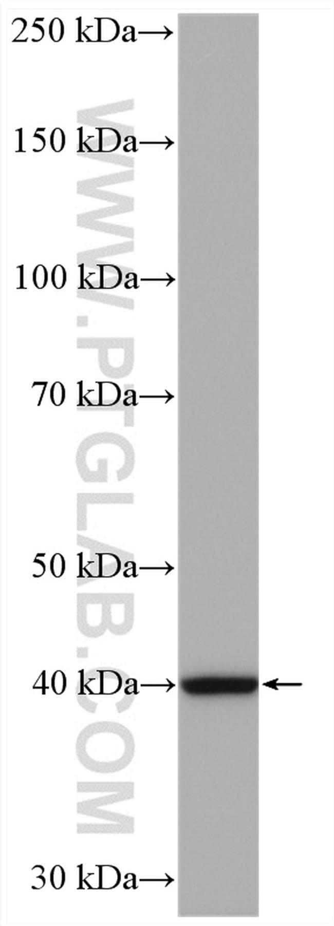 RPP40 Antibody in Western Blot (WB)