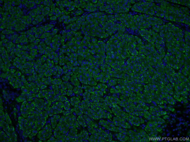 ASGR1 Antibody in Immunohistochemistry (PFA fixed) (IHC (PFA))