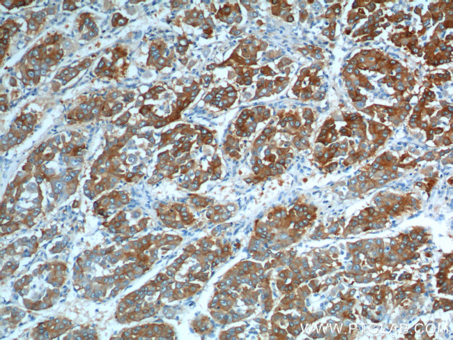 ASGR1 Antibody in Immunohistochemistry (Paraffin) (IHC (P))