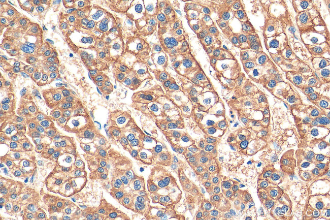 ASGR1 Antibody in Immunohistochemistry (Paraffin) (IHC (P))